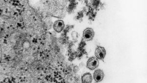 Learn about the pathogen HIV causing the disease AIDS, its treatments and effects