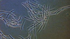Examine how bacteria can be beneficial ecological agents of decomposition but harmful spoilers of food and agents of disease