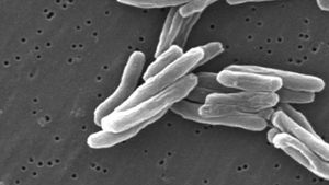 Know why tuberculosis still poses a threat to humans and why the fight against this disease is far from over