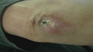 See how wounds heal
